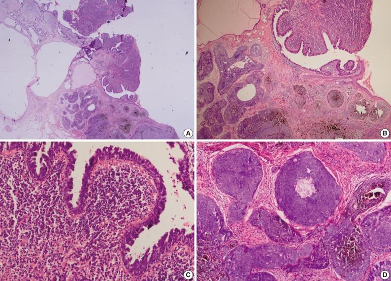 https://cdn.ncbi.nlm.nih.gov/pmc/blobs/25b6/3887160/d451bbf168d4/kjpathol-47-569-g002.jpg