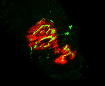 https://cdn.ncbi.nlm.nih.gov/pmc/blobs/25be/12060605/254b597ff0f2/DNEU-85-0-g004.jpg