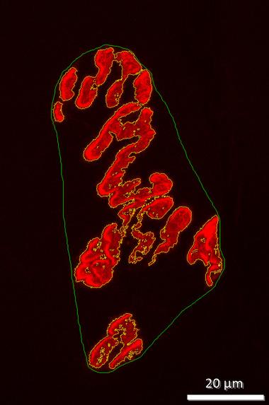 https://cdn.ncbi.nlm.nih.gov/pmc/blobs/25be/12060605/27ac23728a34/DNEU-85-0-g001.jpg