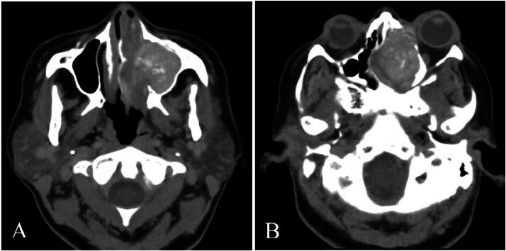 https://cdn.ncbi.nlm.nih.gov/pmc/blobs/25ca/11366909/532f5ddbab6c/gr1.jpg