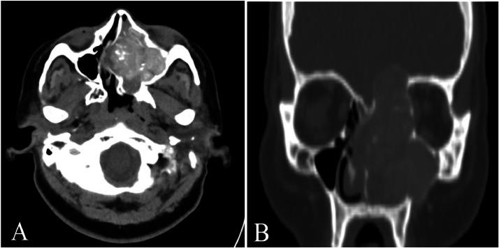 https://cdn.ncbi.nlm.nih.gov/pmc/blobs/25ca/11366909/71991b20c934/gr2.jpg