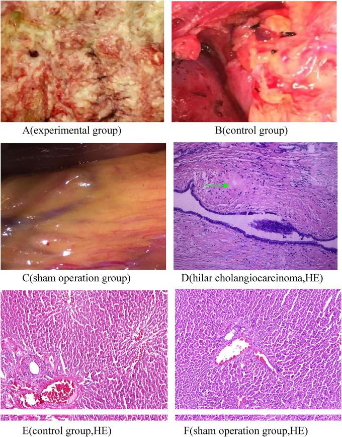 https://cdn.ncbi.nlm.nih.gov/pmc/blobs/25d1/9228640/072ca036cac8/10.1177_15330338221109646-fig1.jpg