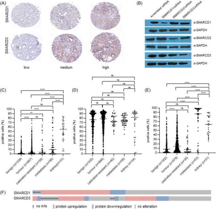 https://cdn.ncbi.nlm.nih.gov/pmc/blobs/25d3/11648064/45cbf42d138c/PROS-85-181-g001.jpg