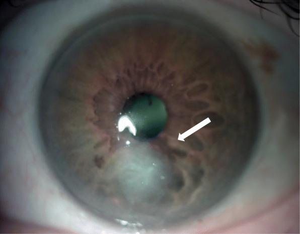 https://cdn.ncbi.nlm.nih.gov/pmc/blobs/25da/7814578/5ddc49d86439/12879_2021_5768_Fig3_HTML.jpg