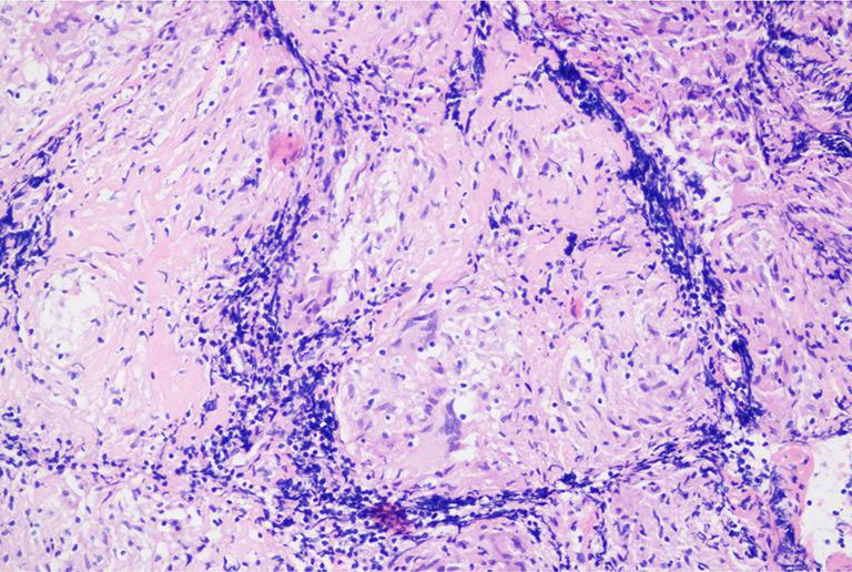 https://cdn.ncbi.nlm.nih.gov/pmc/blobs/25de/11070980/399ca52e5c67/acr-08-23-160-f5.jpg