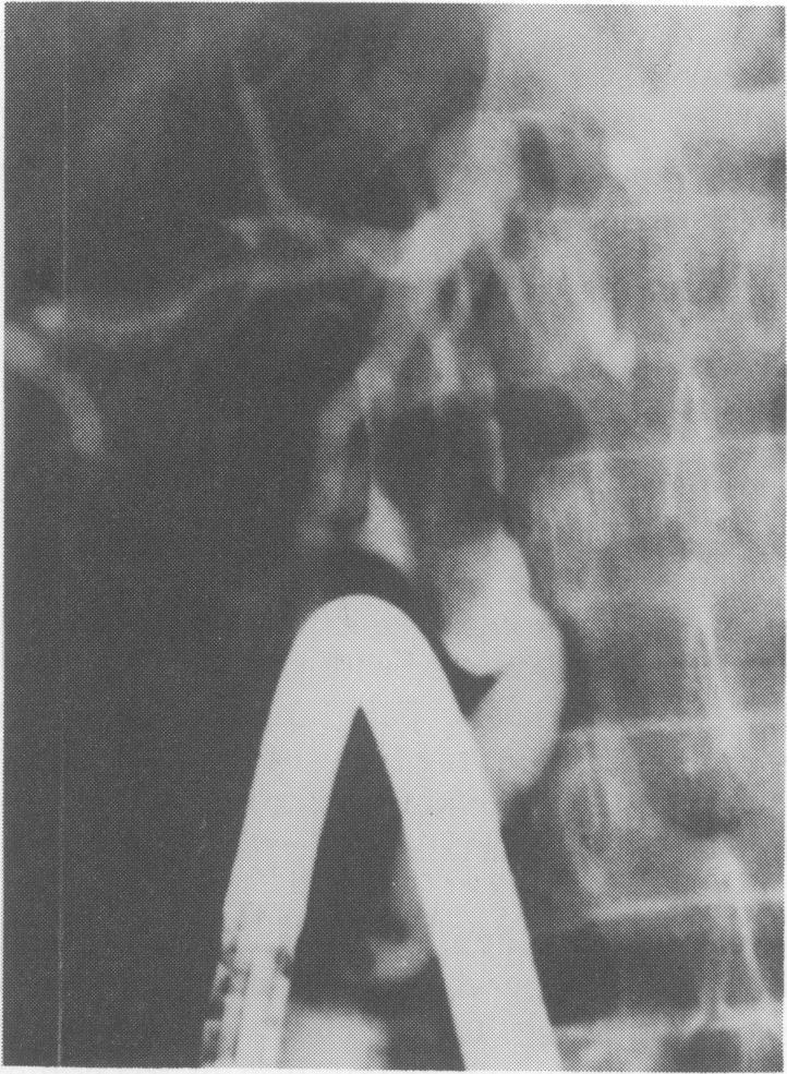 https://cdn.ncbi.nlm.nih.gov/pmc/blobs/25e8/2399498/d78c0ac62a01/postmedj00072-0027-b.jpg