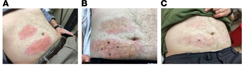 https://cdn.ncbi.nlm.nih.gov/pmc/blobs/25e9/11128198/126b507e8596/jciinsight-9-175375-g218.jpg