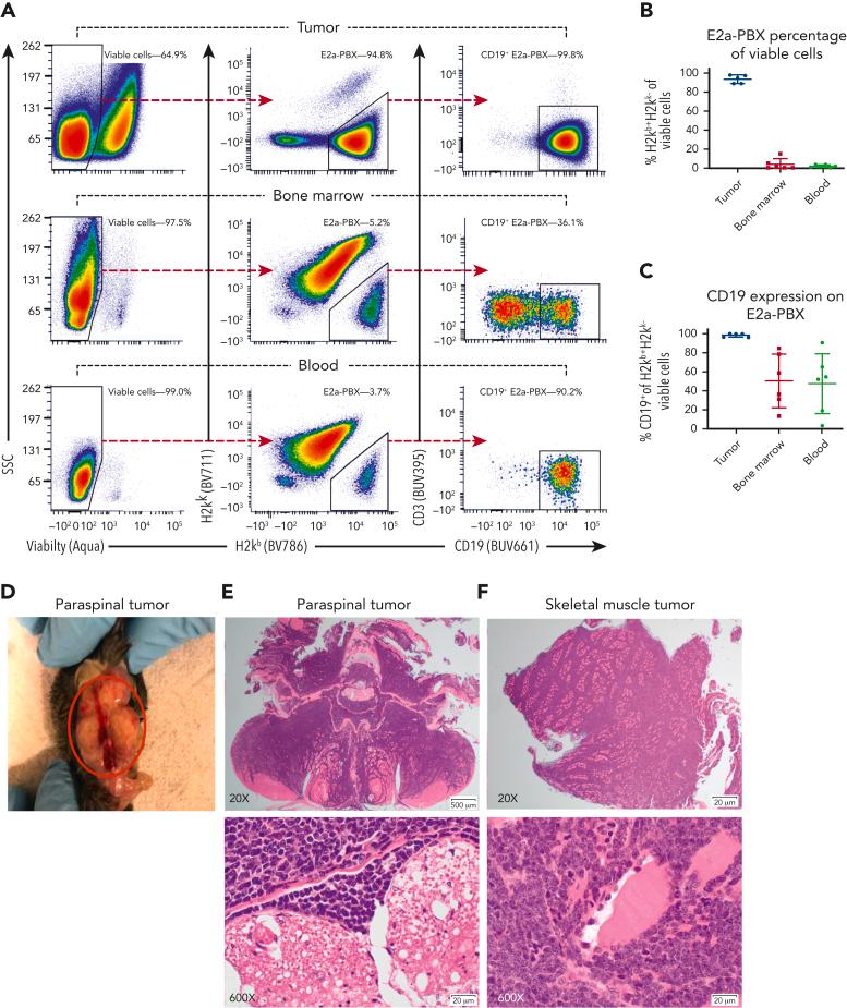 https://cdn.ncbi.nlm.nih.gov/pmc/blobs/25f2/9979711/a01b3ec72942/BLOOD_BLD-2022-016660-gr2.jpg