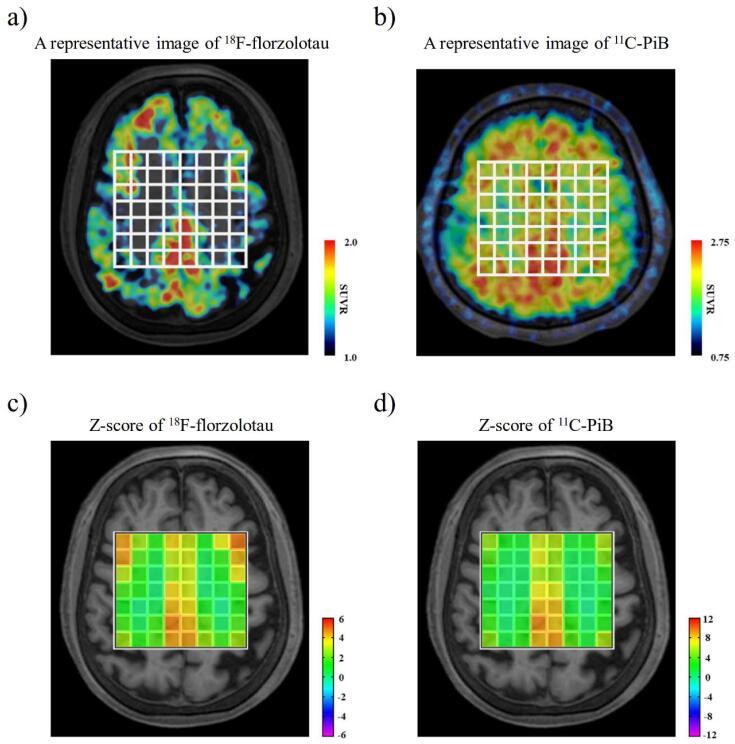 https://cdn.ncbi.nlm.nih.gov/pmc/blobs/25f7/10944210/7c483d2d8090/gr2.jpg
