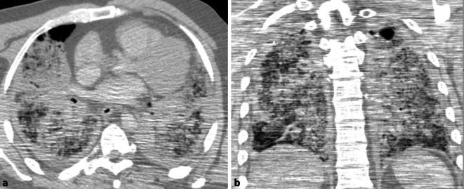 https://cdn.ncbi.nlm.nih.gov/pmc/blobs/25f8/7247437/2f5ee08d4abd/194_2020_401_Fig1_HTML.jpg