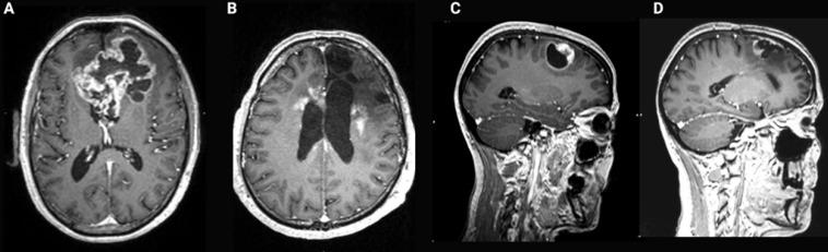 https://cdn.ncbi.nlm.nih.gov/pmc/blobs/25fb/8315062/a17c895f83ff/thnov11p7911g008.jpg