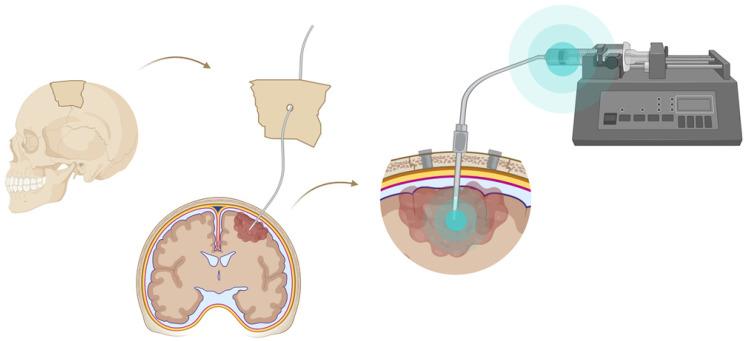 https://cdn.ncbi.nlm.nih.gov/pmc/blobs/25fb/8315062/cf6033d385d0/thnov11p7911g004.jpg