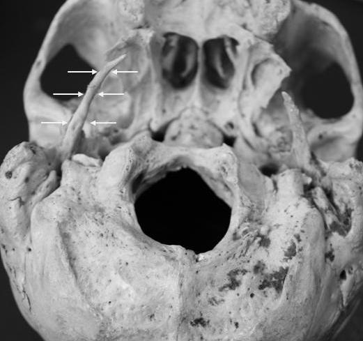 https://cdn.ncbi.nlm.nih.gov/pmc/blobs/2605/2803932/8c3cc7eb9596/1757-1626-2-9135-2.jpg