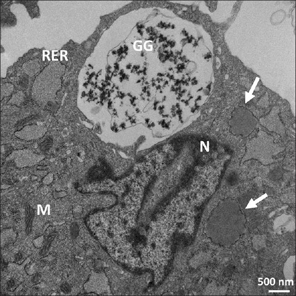 https://cdn.ncbi.nlm.nih.gov/pmc/blobs/2609/6585478/045b37214ddd/JMAU-7-57-g004.jpg