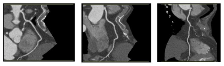 https://cdn.ncbi.nlm.nih.gov/pmc/blobs/2611/11765955/75c2a163ed9b/jcm-14-00354-g004.jpg