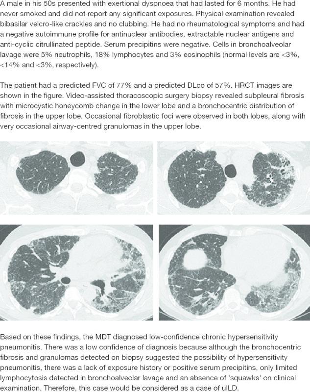 https://cdn.ncbi.nlm.nih.gov/pmc/blobs/2616/6135451/cc42d976832c/bmjresp-2018-000289f04.jpg