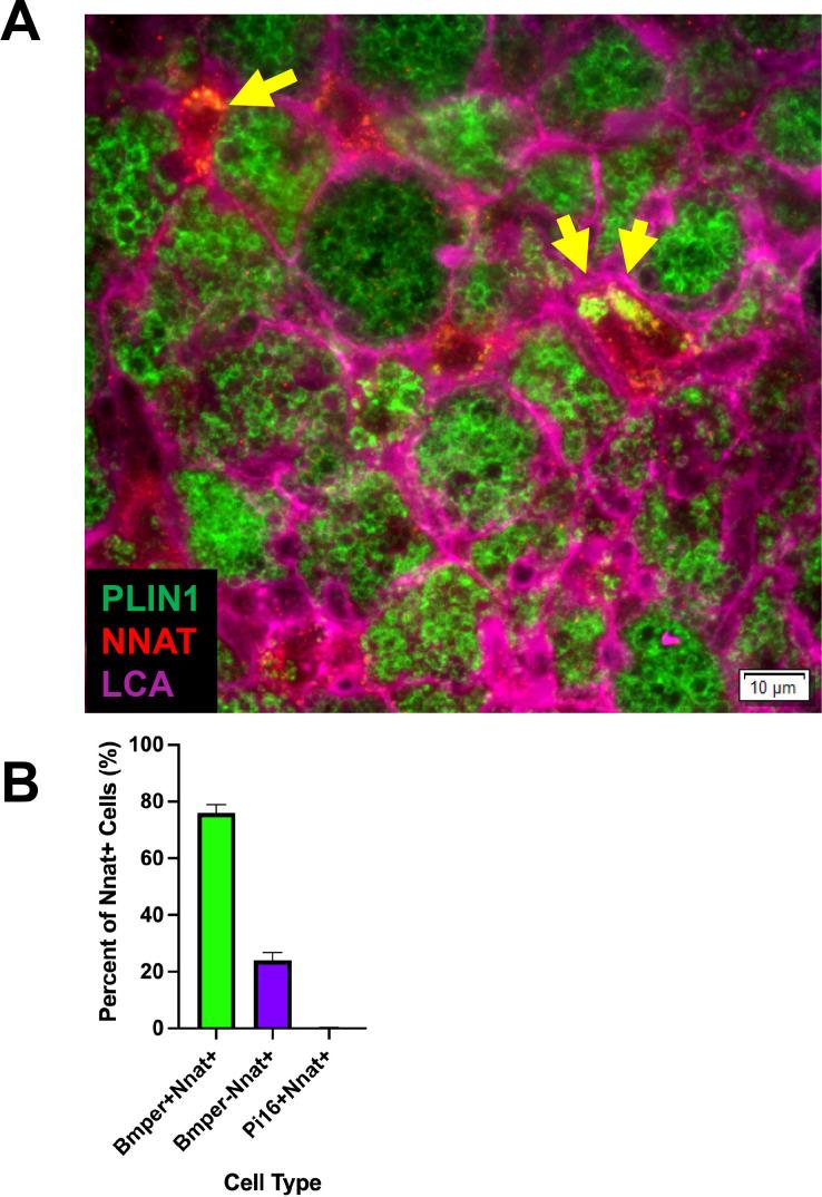 https://cdn.ncbi.nlm.nih.gov/pmc/blobs/261d/9348851/67a2308d7415/elife-80167-fig4-figsupp1.jpg