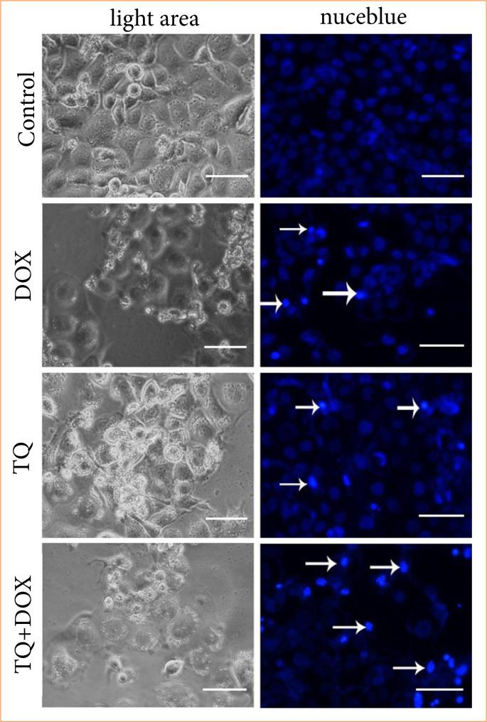 https://cdn.ncbi.nlm.nih.gov/pmc/blobs/261e/11960576/a9c31954ac9a/1678-2674-acb-40-e401725-gf05.jpg