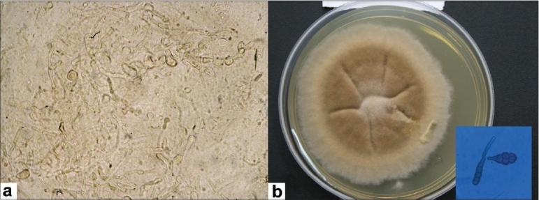 https://cdn.ncbi.nlm.nih.gov/pmc/blobs/2625/2854454/04b0998b5bbf/IJO-58-162-g002.jpg