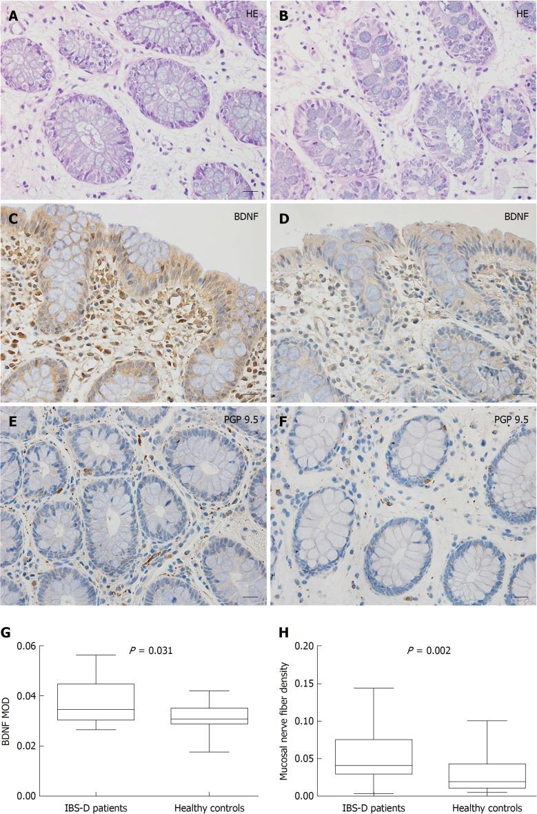 https://cdn.ncbi.nlm.nih.gov/pmc/blobs/2626/6337018/9f6aa6d430ee/WJG-25-269-g002.jpg