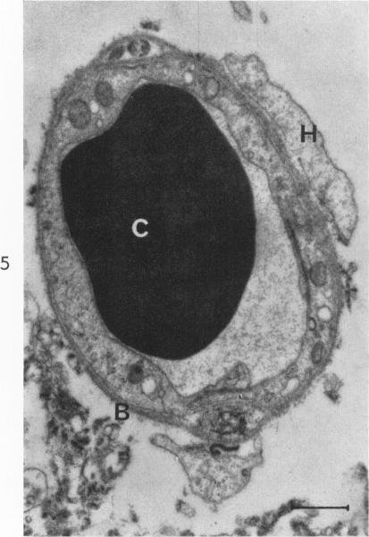 https://cdn.ncbi.nlm.nih.gov/pmc/blobs/2628/1907024/58566bff8ae4/amjpathol00305-0028-d.jpg
