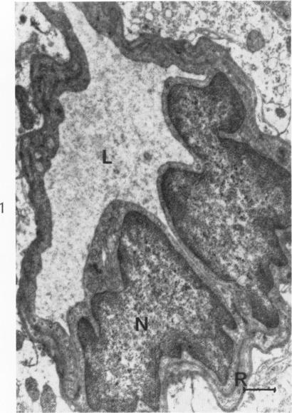 https://cdn.ncbi.nlm.nih.gov/pmc/blobs/2628/1907024/ea881f4da0a6/amjpathol00305-0028-a.jpg