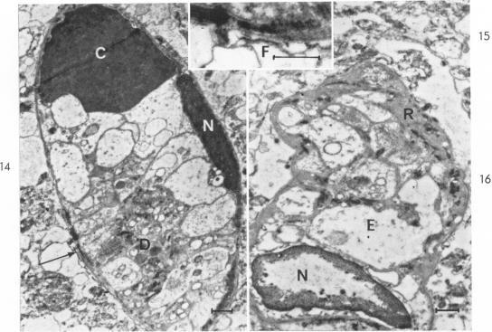 https://cdn.ncbi.nlm.nih.gov/pmc/blobs/2628/1907024/f29f5c4d9ae8/amjpathol00305-0034-a.jpg