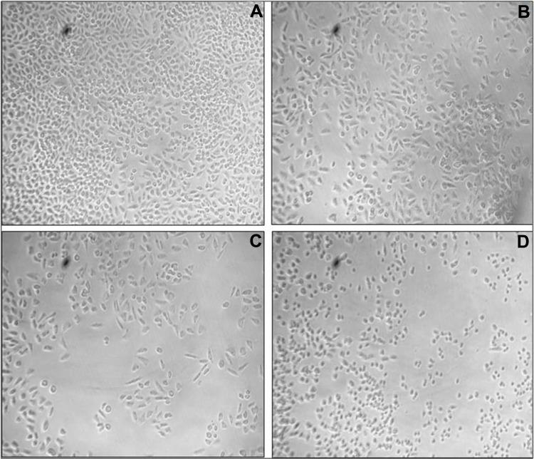 https://cdn.ncbi.nlm.nih.gov/pmc/blobs/2629/8612025/66751df9ed09/IJN-16-7711-g0007.jpg