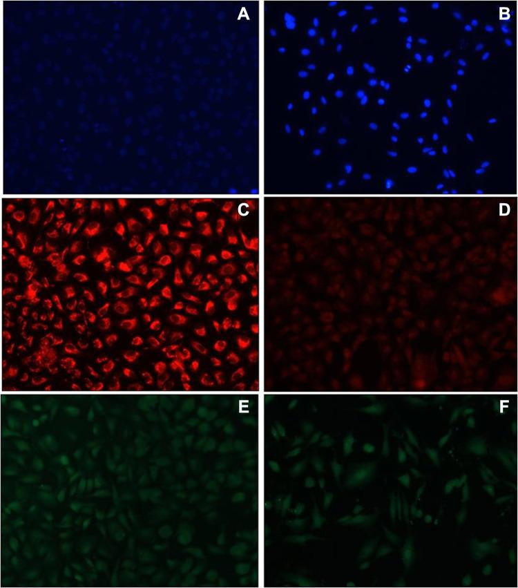 https://cdn.ncbi.nlm.nih.gov/pmc/blobs/2629/8612025/70a65840d691/IJN-16-7711-g0008.jpg