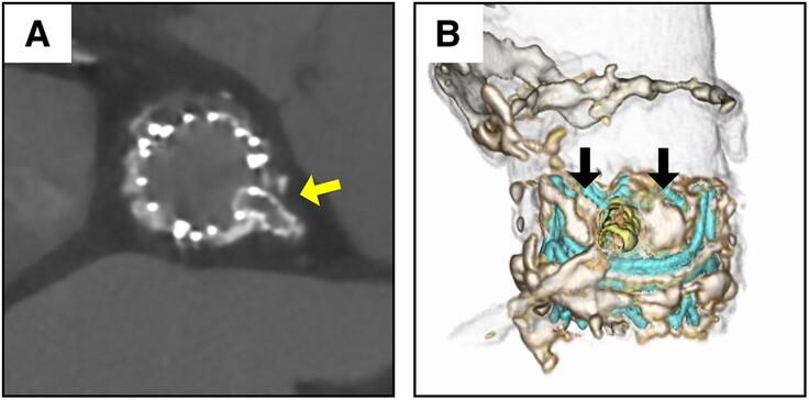 https://cdn.ncbi.nlm.nih.gov/pmc/blobs/2630/11647591/71014ca9af26/ytae643f3.jpg