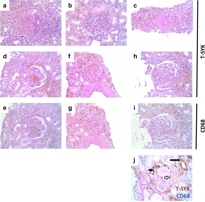 https://cdn.ncbi.nlm.nih.gov/pmc/blobs/2638/7242903/9559fd803ad6/gr6.jpg