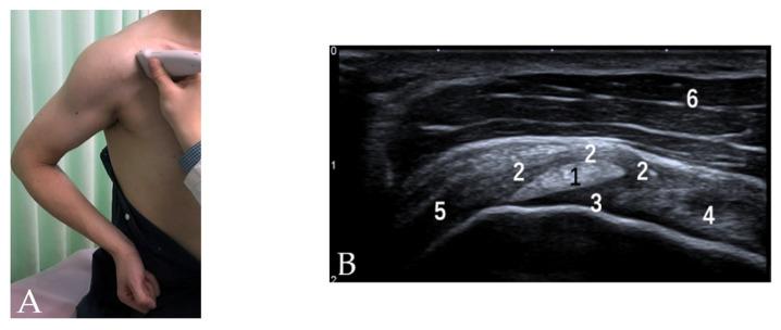 https://cdn.ncbi.nlm.nih.gov/pmc/blobs/2638/8947553/4696b808e4d2/diagnostics-12-00659-g001.jpg
