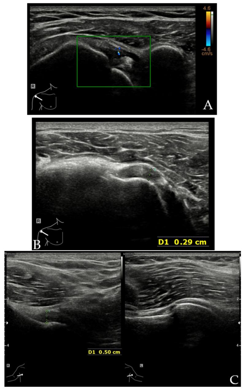 https://cdn.ncbi.nlm.nih.gov/pmc/blobs/2638/8947553/ada59f6d43bb/diagnostics-12-00659-g008a.jpg