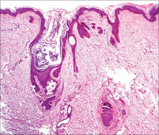 https://cdn.ncbi.nlm.nih.gov/pmc/blobs/263b/5621214/b87e7befb019/IDOJ-8-388-g003.jpg