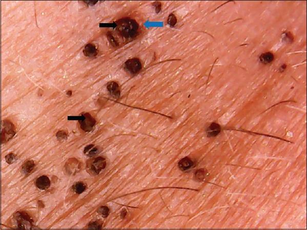 https://cdn.ncbi.nlm.nih.gov/pmc/blobs/263b/5621214/ce94cbec004f/IDOJ-8-388-g002.jpg