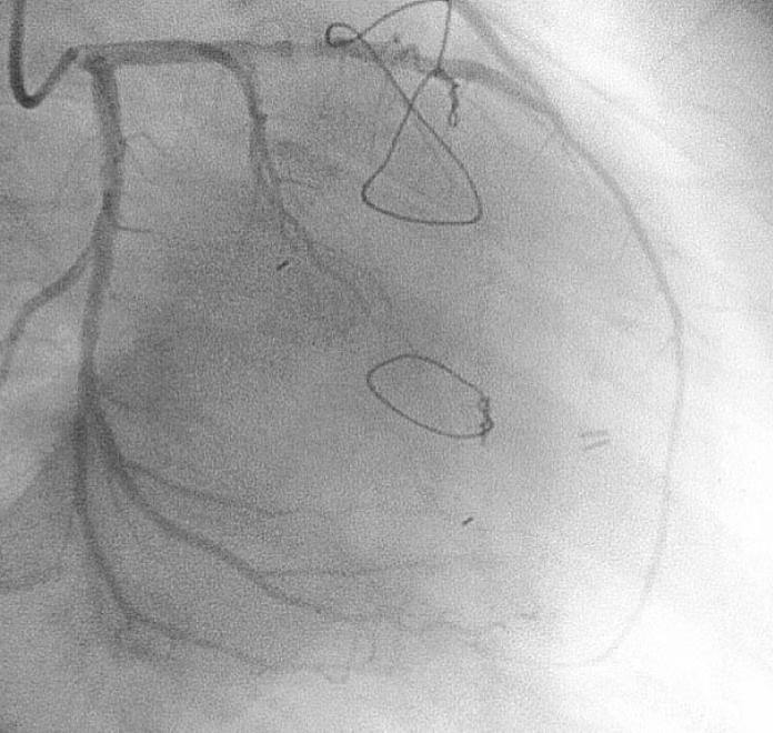 https://cdn.ncbi.nlm.nih.gov/pmc/blobs/263d/2796416/3ce3cd3d8573/ymj-50-852-g003.jpg