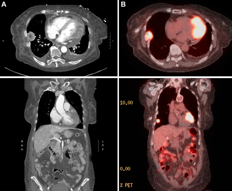https://cdn.ncbi.nlm.nih.gov/pmc/blobs/2640/12243059/018cf7e2df1e/gr2.jpg
