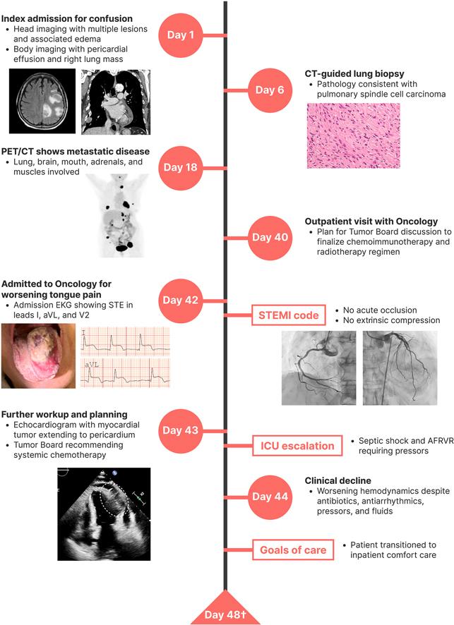 https://cdn.ncbi.nlm.nih.gov/pmc/blobs/2640/12243059/8708d5c07e66/ga1.jpg