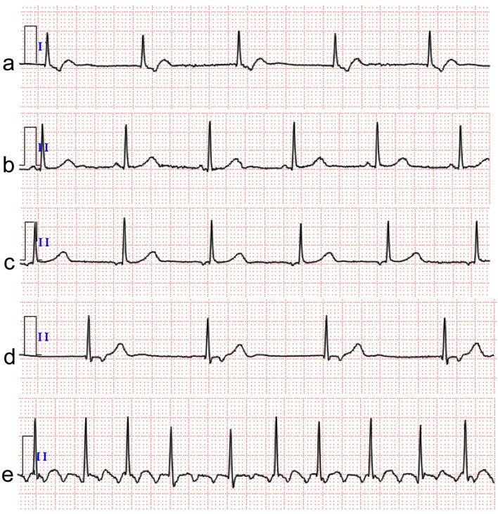 https://cdn.ncbi.nlm.nih.gov/pmc/blobs/2641/12074686/9401af0edba2/cr-16-03-289-g001.jpg