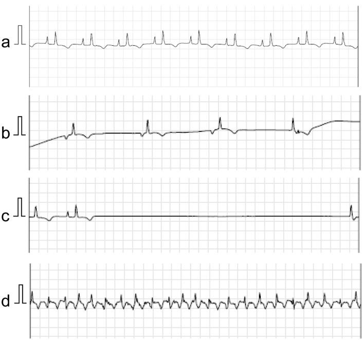 https://cdn.ncbi.nlm.nih.gov/pmc/blobs/2641/12074686/ca8d26074d01/cr-16-03-289-g004.jpg