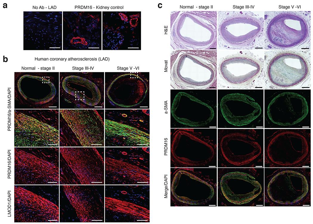 https://cdn.ncbi.nlm.nih.gov/pmc/blobs/2643/9203933/426694a0b4fc/nihms-1794783-f0015.jpg