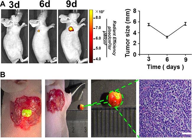 https://cdn.ncbi.nlm.nih.gov/pmc/blobs/2644/5351629/1c27281267e0/oncotarget-08-6258-g004.jpg