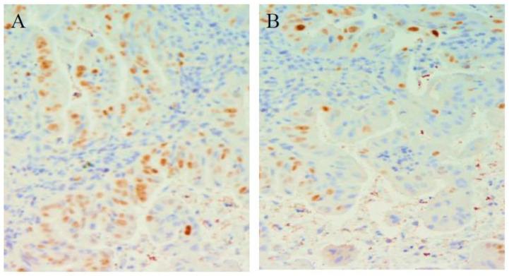 https://cdn.ncbi.nlm.nih.gov/pmc/blobs/2647/10296950/34d43177234f/cimb-45-00299-g005.jpg