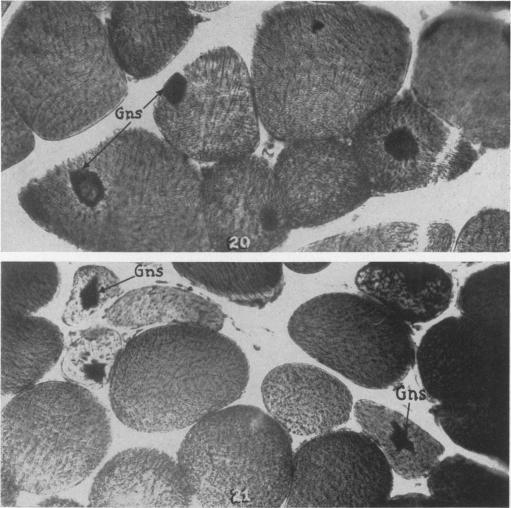 https://cdn.ncbi.nlm.nih.gov/pmc/blobs/2647/1942724/850c13b8d868/amjpathol00603-0161-a.jpg