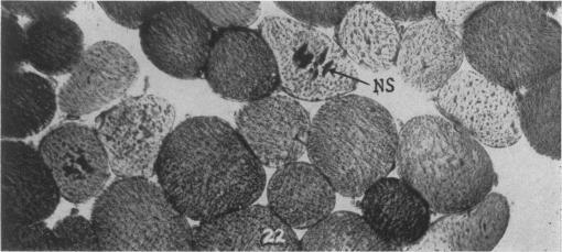 https://cdn.ncbi.nlm.nih.gov/pmc/blobs/2647/1942724/e372fa678891/amjpathol00603-0161-b.jpg