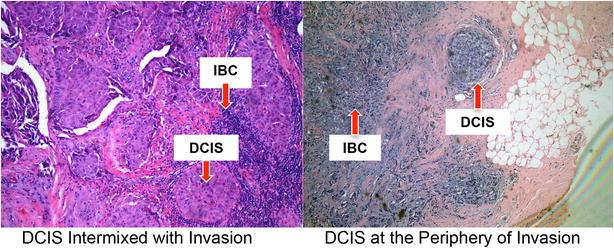 https://cdn.ncbi.nlm.nih.gov/pmc/blobs/2647/4619378/36b9a4c6a769/12967_2015_698_Fig2_HTML.jpg