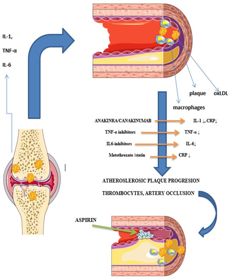 https://cdn.ncbi.nlm.nih.gov/pmc/blobs/2648/10534747/fdcd691a5e25/medicina-59-01550-g002.jpg