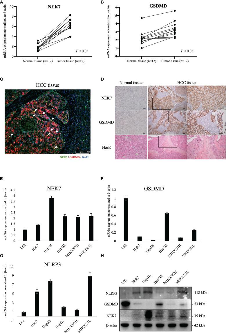 https://cdn.ncbi.nlm.nih.gov/pmc/blobs/2648/8866693/670f6ea8e0e6/fonc-12-812655-g002.jpg