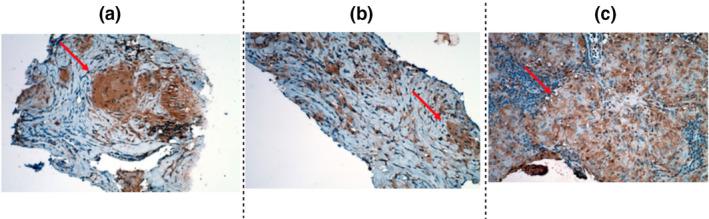 https://cdn.ncbi.nlm.nih.gov/pmc/blobs/264c/8256670/e2619532554d/CTI2-10-e1310-g004.jpg