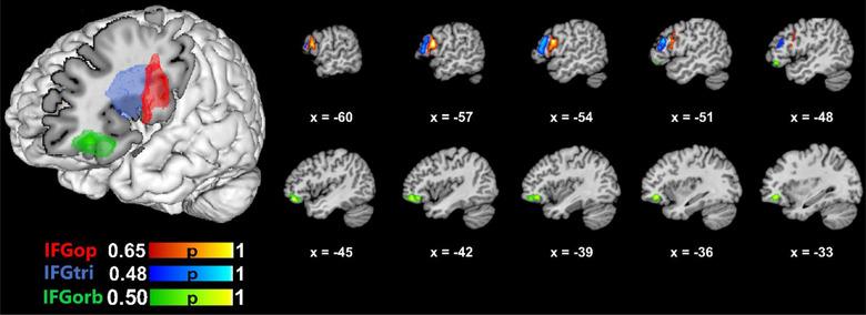 https://cdn.ncbi.nlm.nih.gov/pmc/blobs/264d/10338813/efe10a335bff/BRB3-13-e3046-g004.jpg